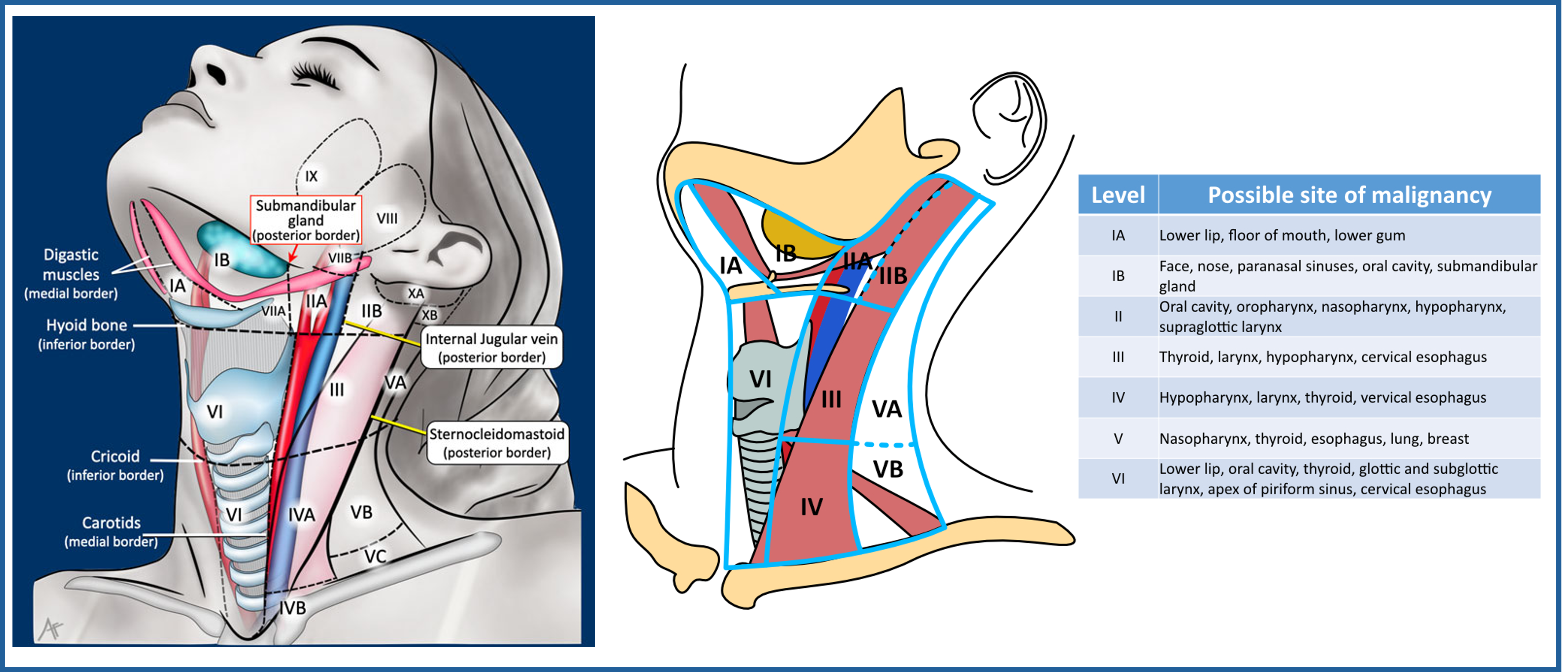 Cervical lymph node levels map and likely primary sites