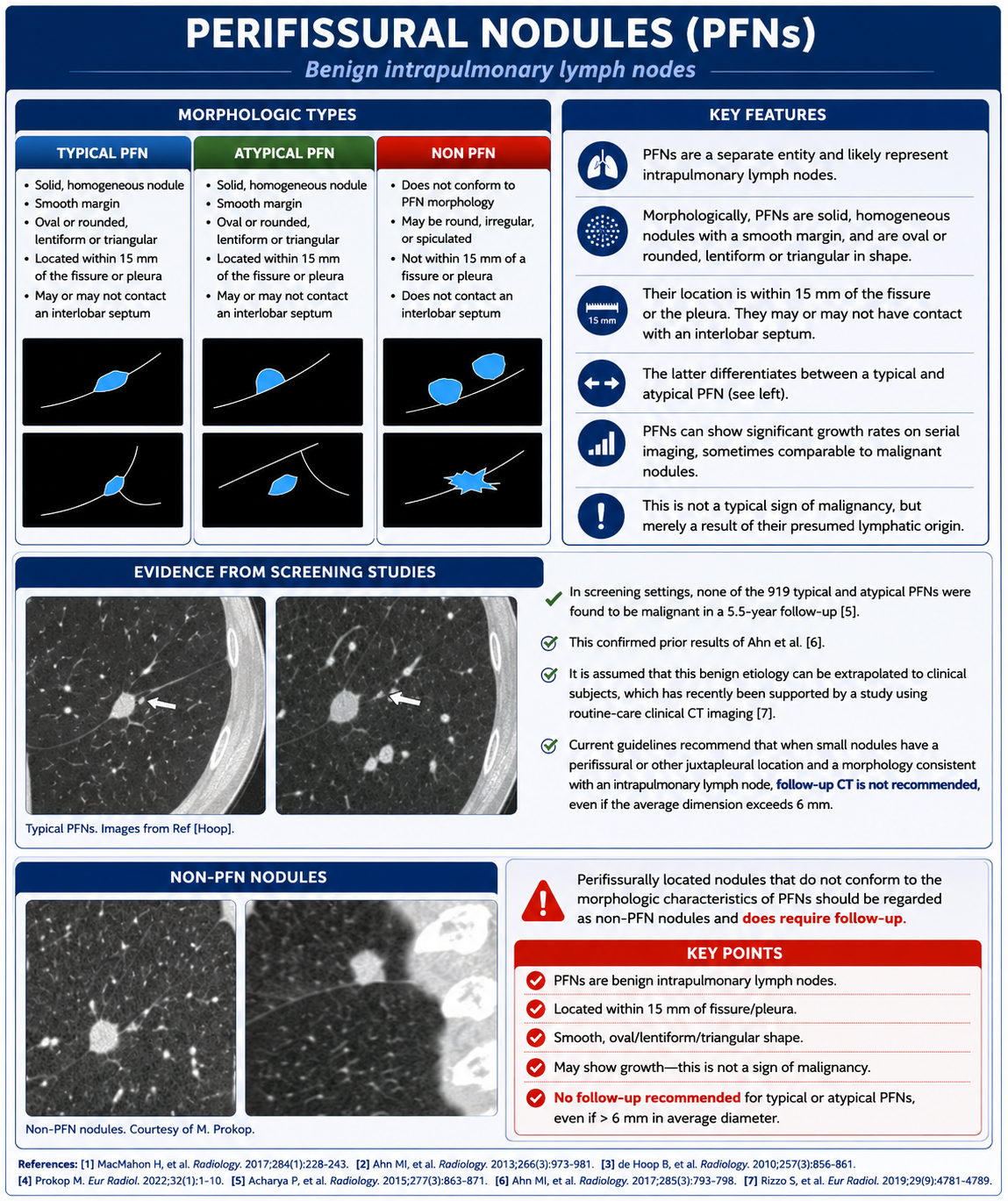 Perifissural nodules and benign intrapulmonary lymph nodes