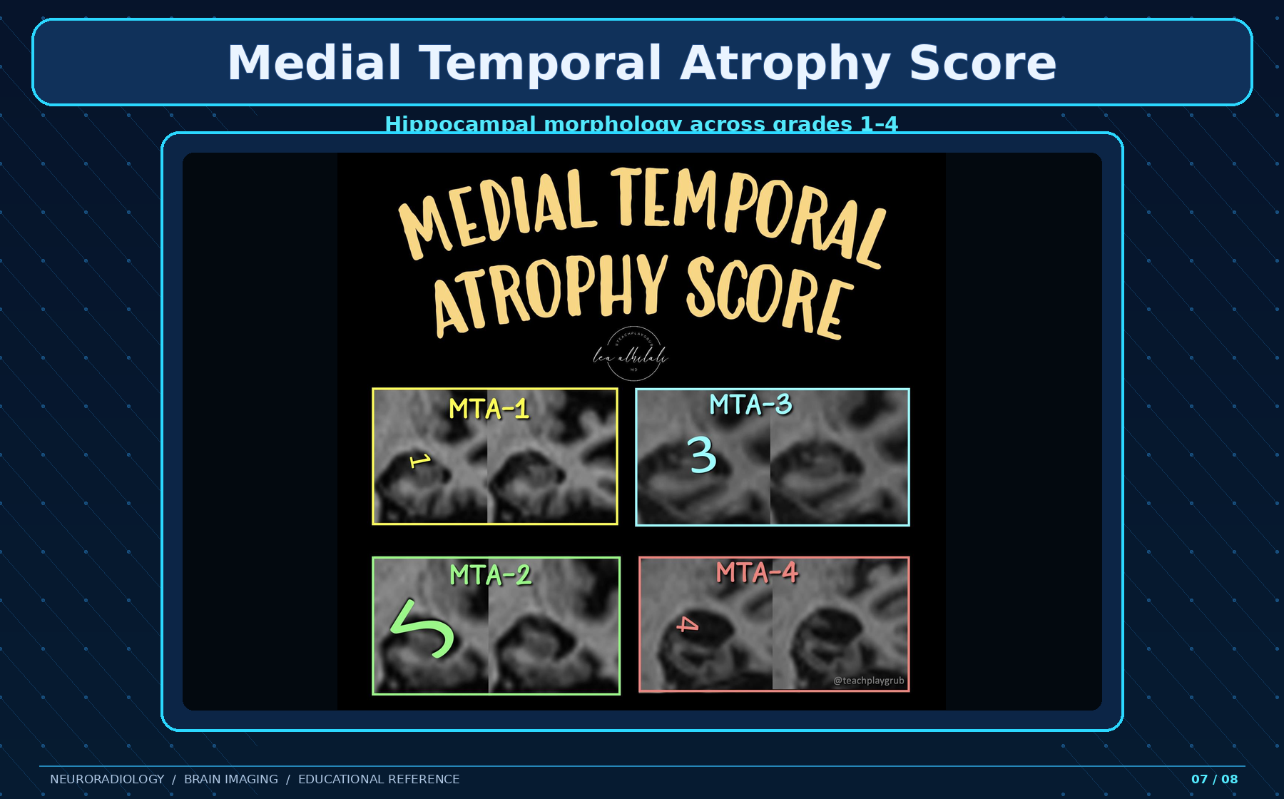 MTA morphology grades
