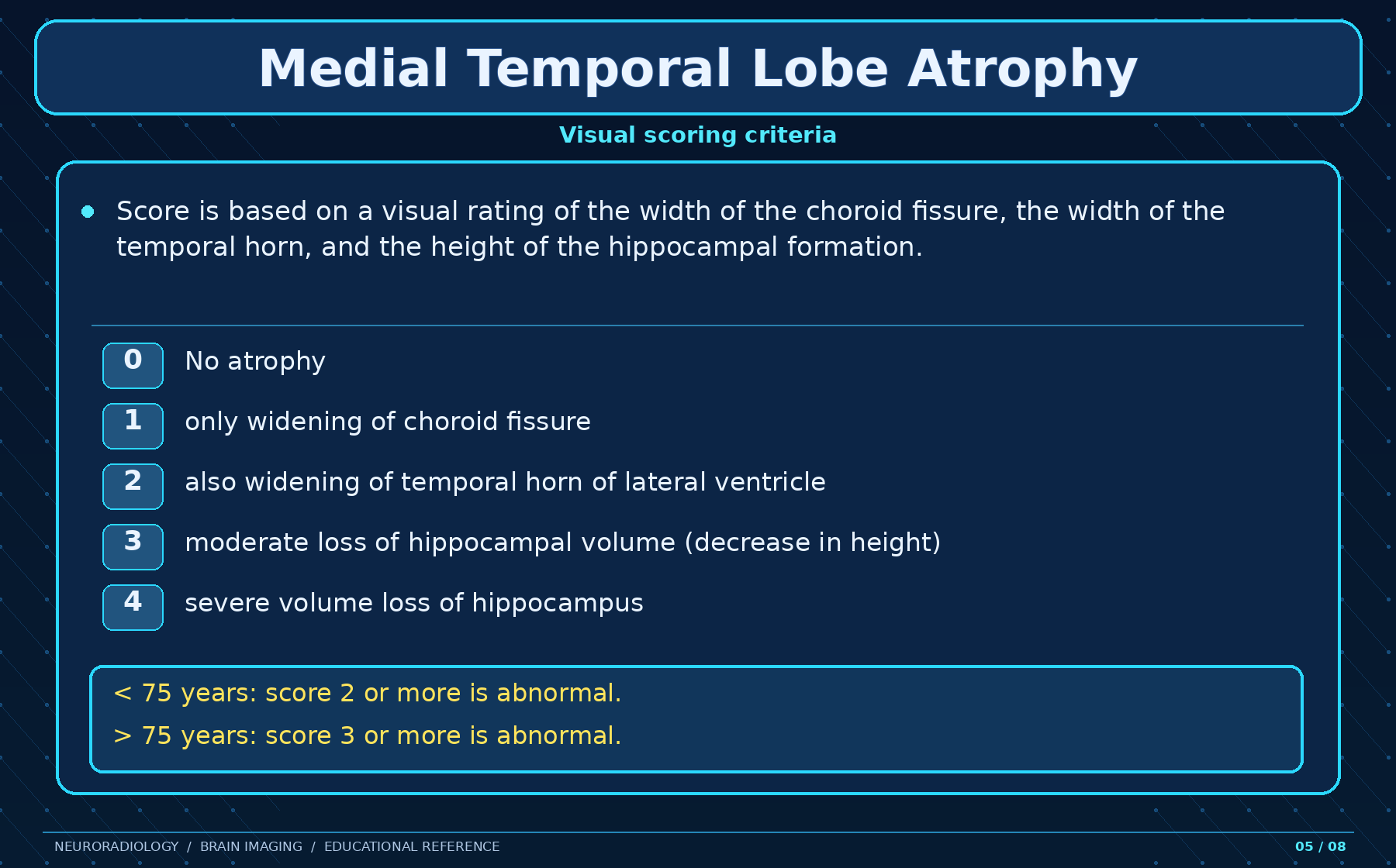 MTA scoring criteria
