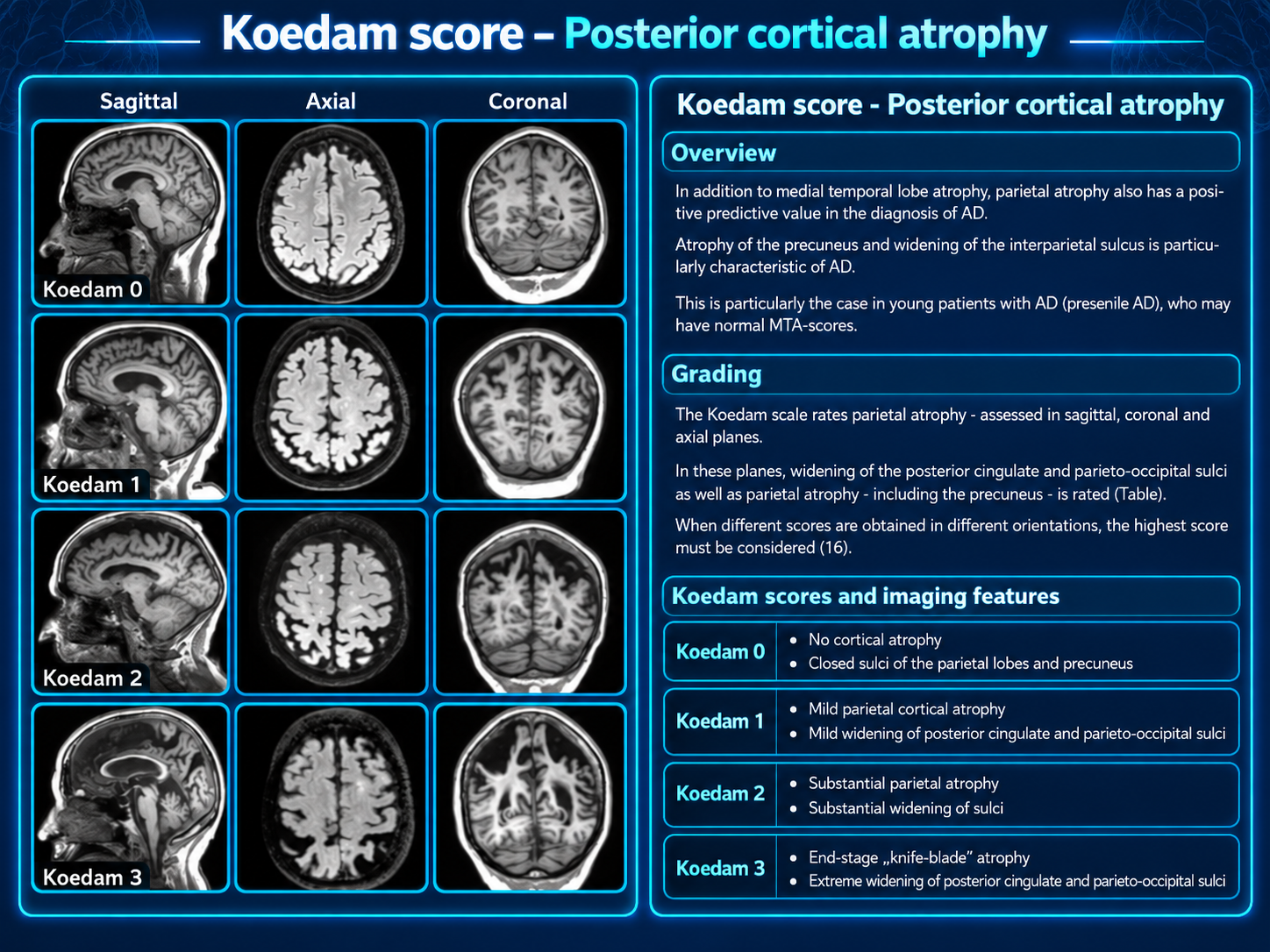 Koedam posterior cortical atrophy score