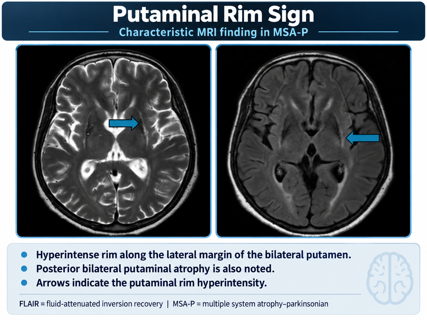 Putman Rim Sign