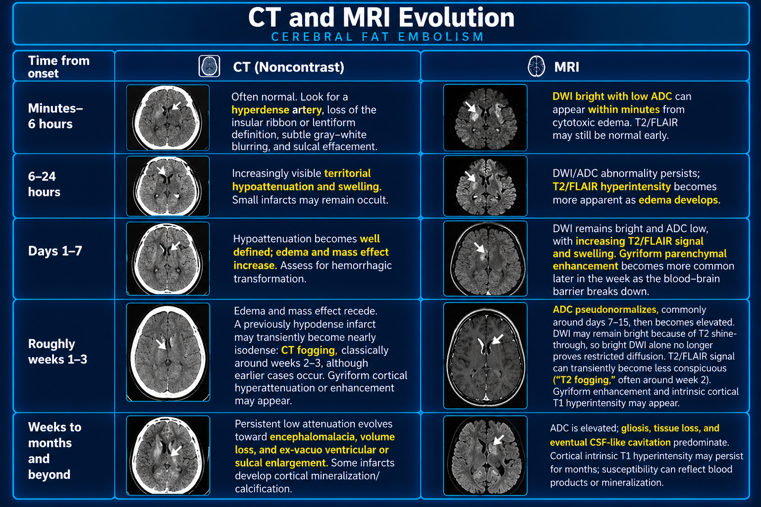 CT and MRI evolution timeline for cerebral infarction from the first minutes through chronic stages