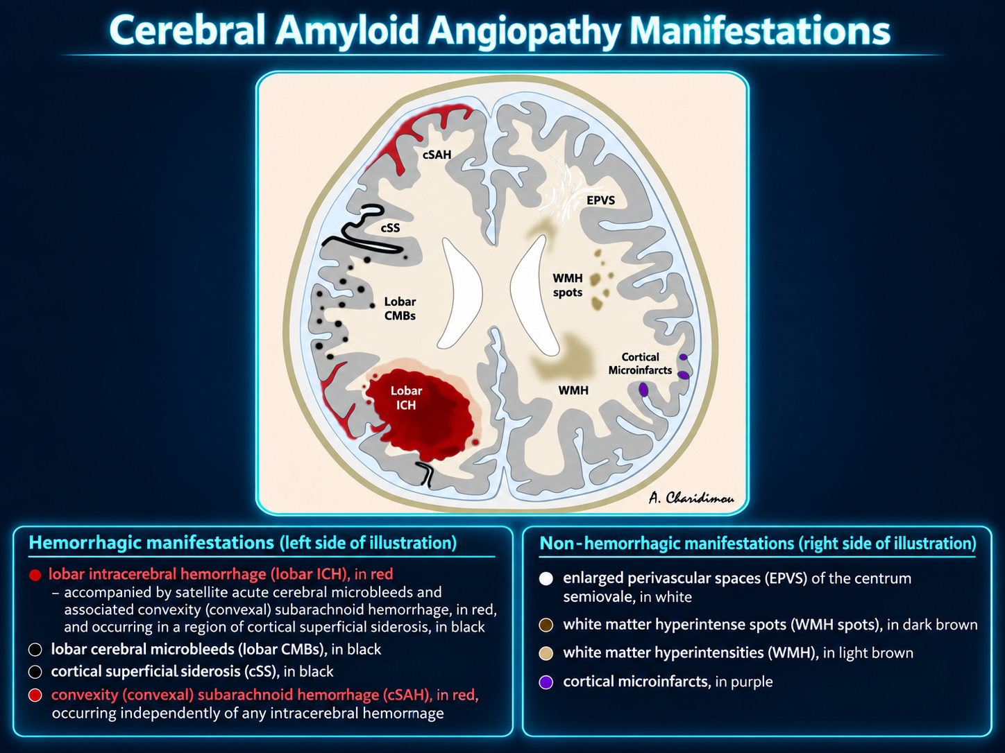Cerebral amyloid angiopathy manifestations
