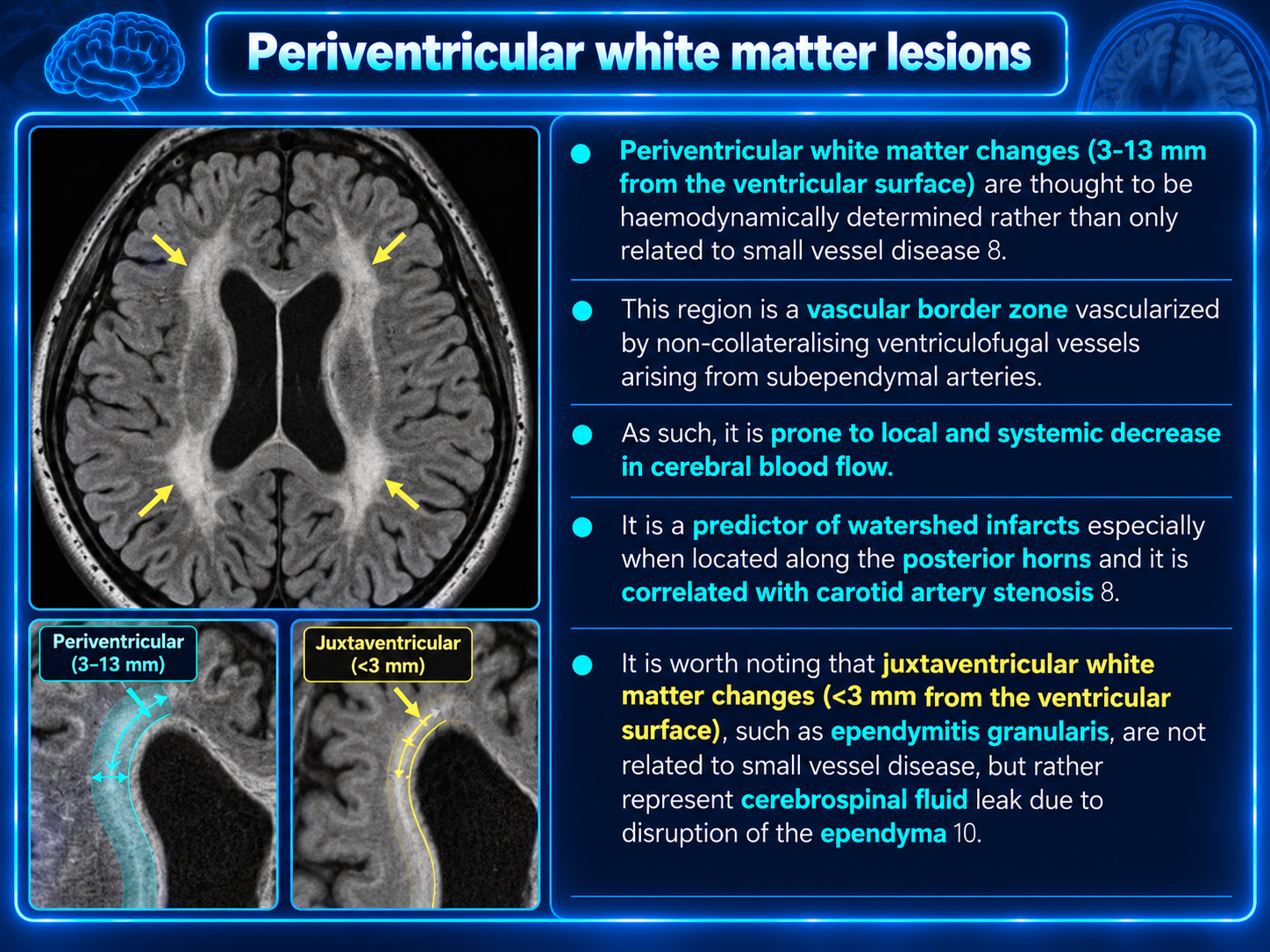Periventricular white matter lesions