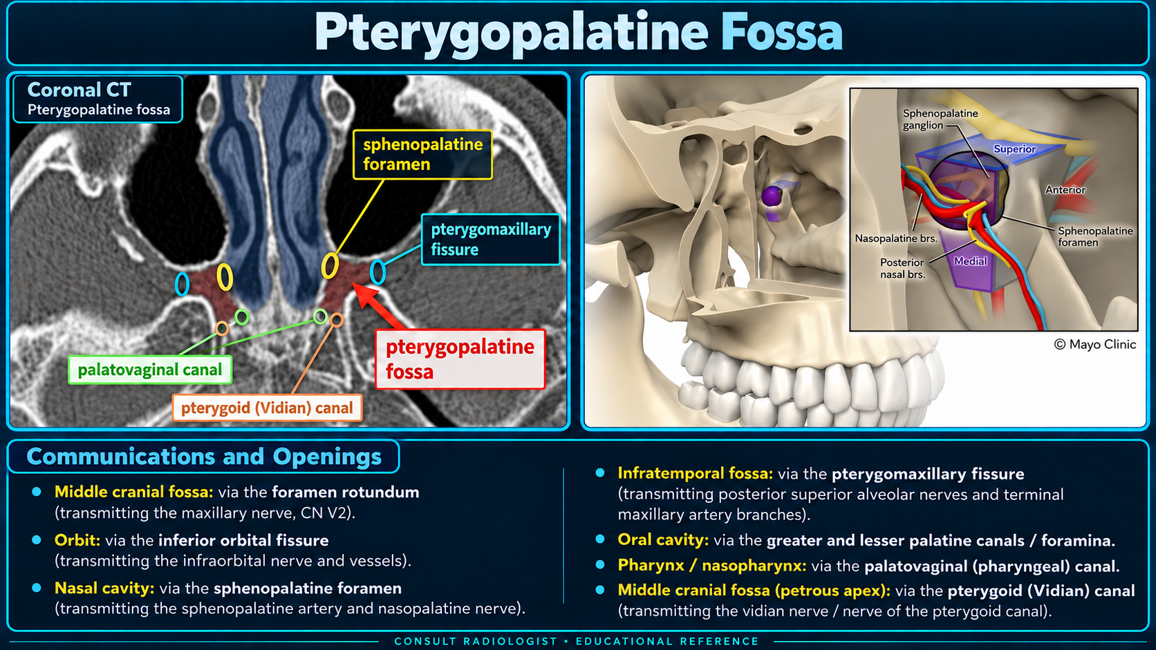 Pterygopalatine fossa CT anatomy and communications