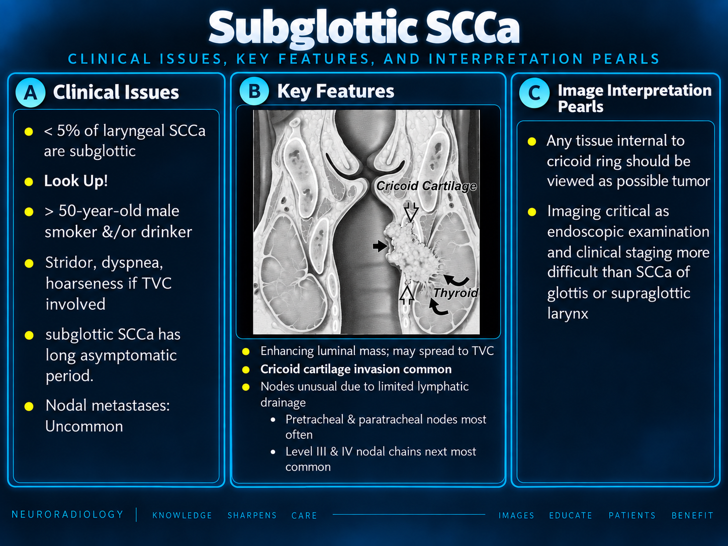 Subglottic SCC clinical issues, key features, and interpretation pearls