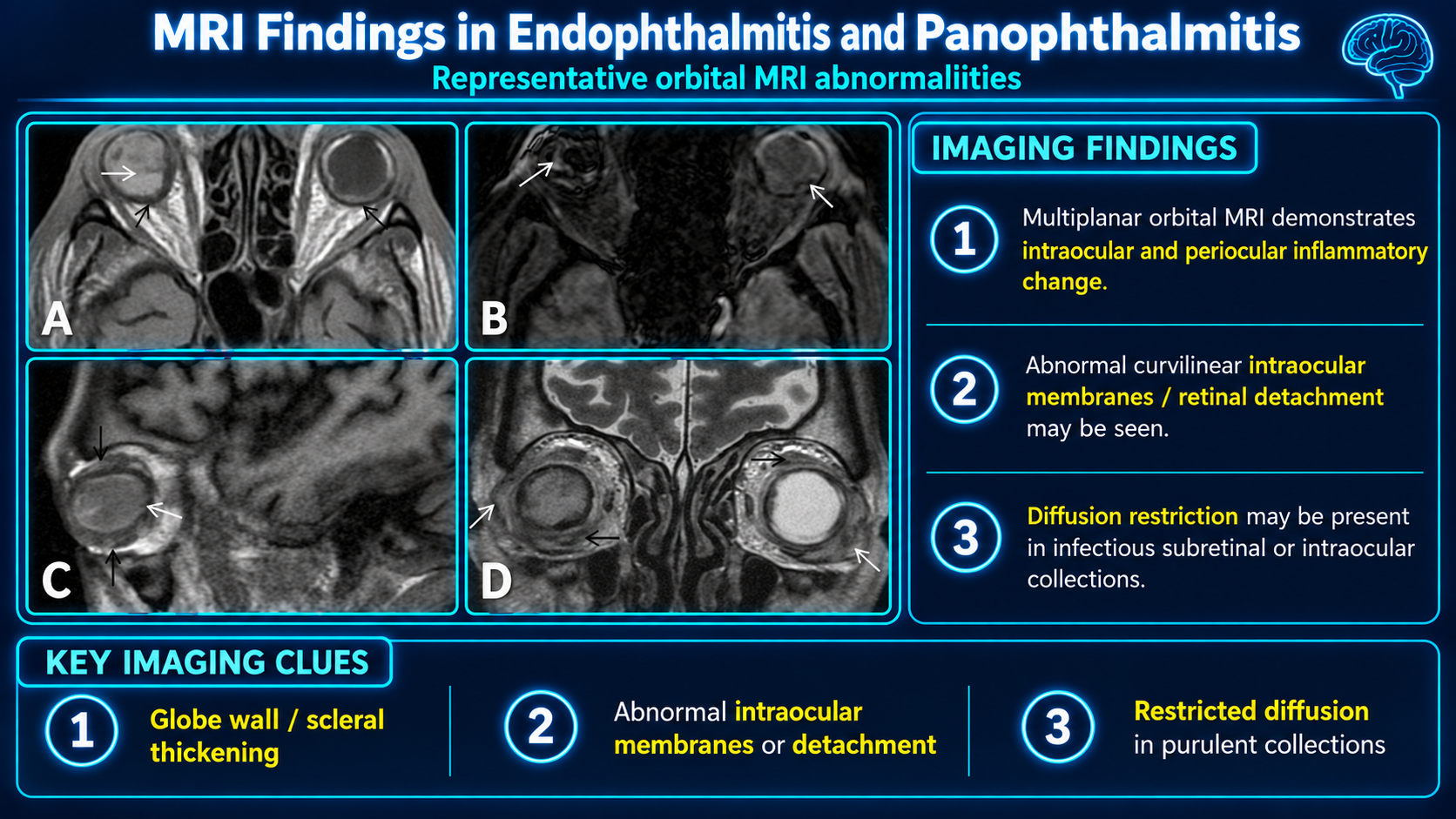 MRI findings in endophthalmitis and panophthalmitis