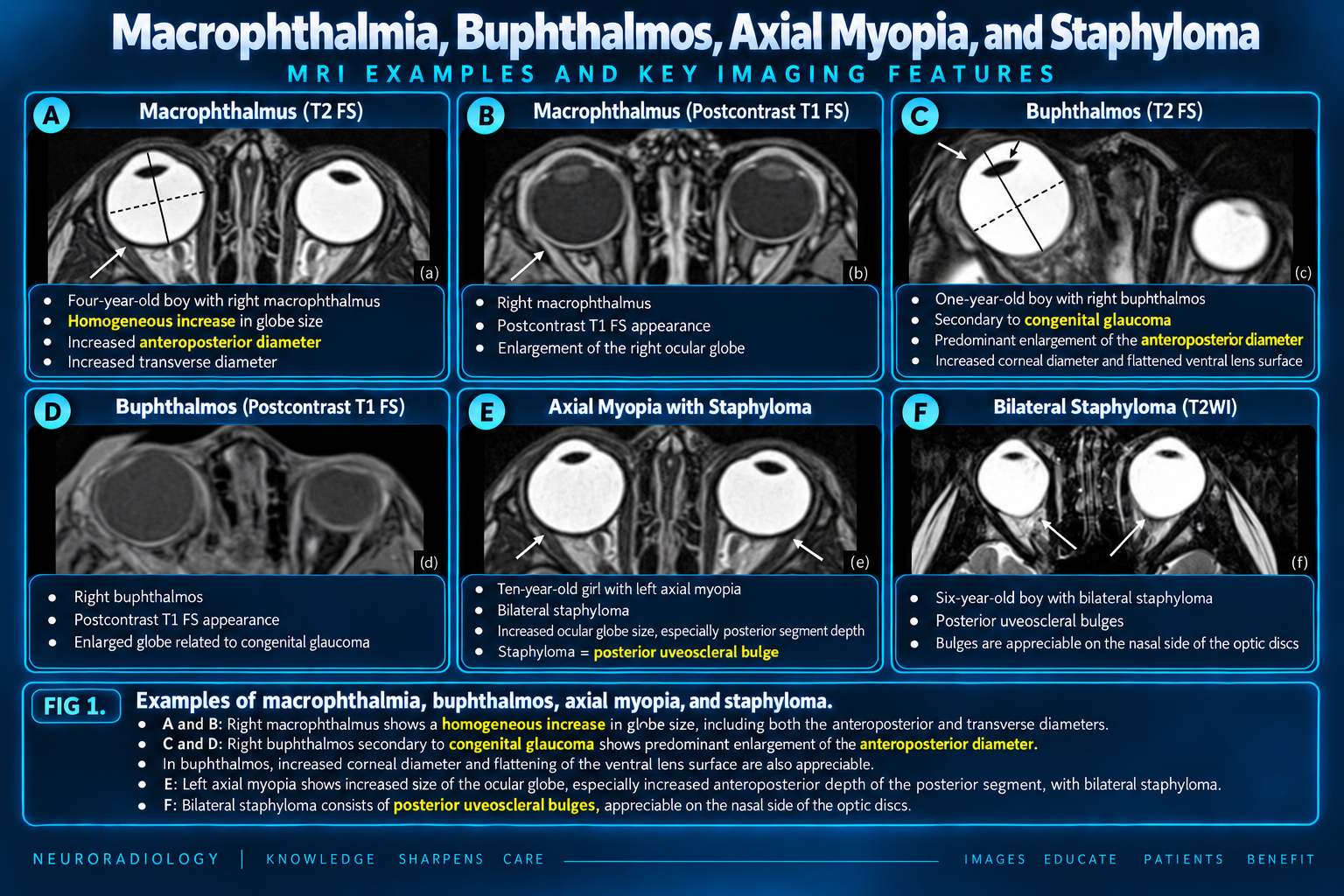 Macrophthalmos