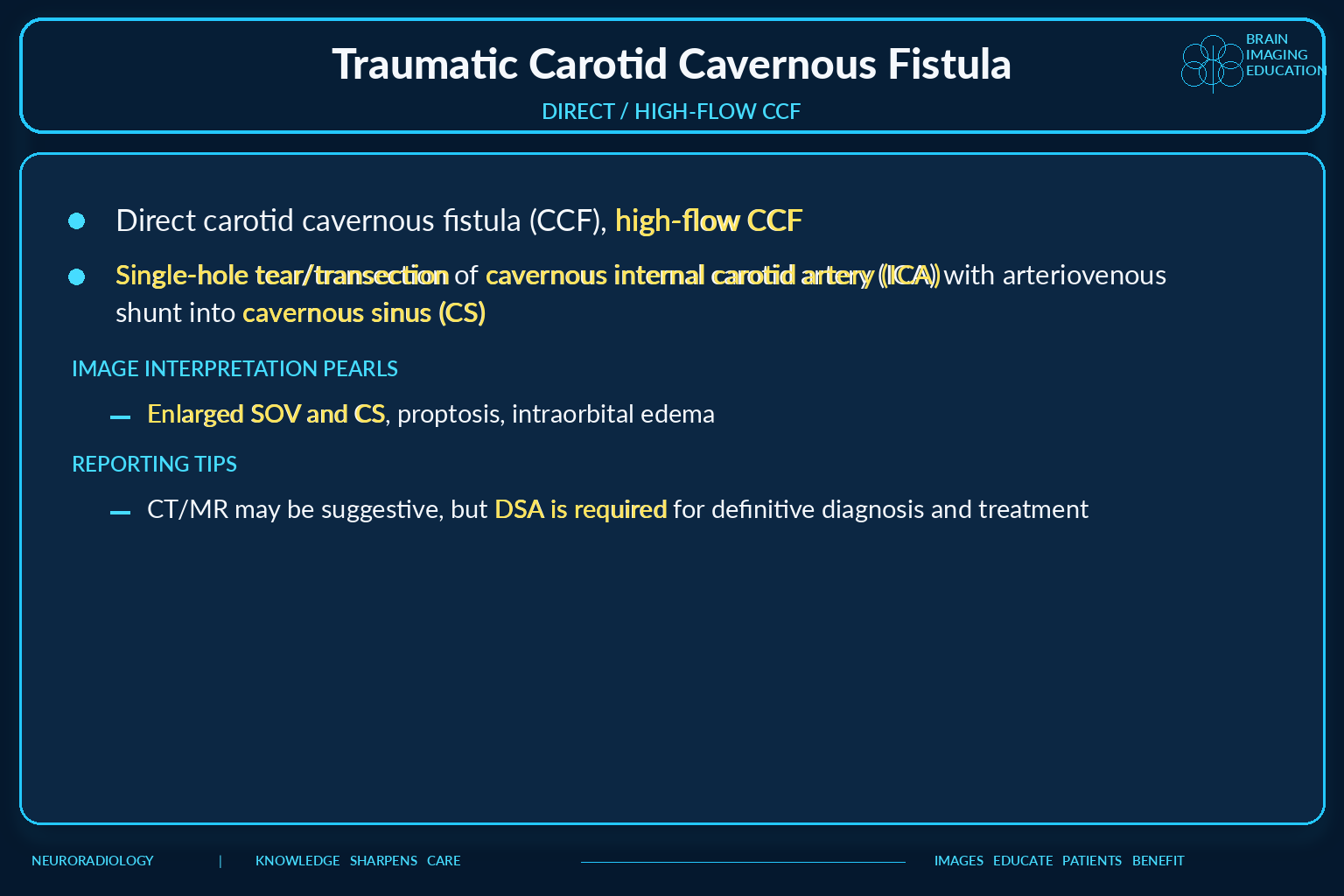 Direct high flow traumatic carotid cavernous fistula