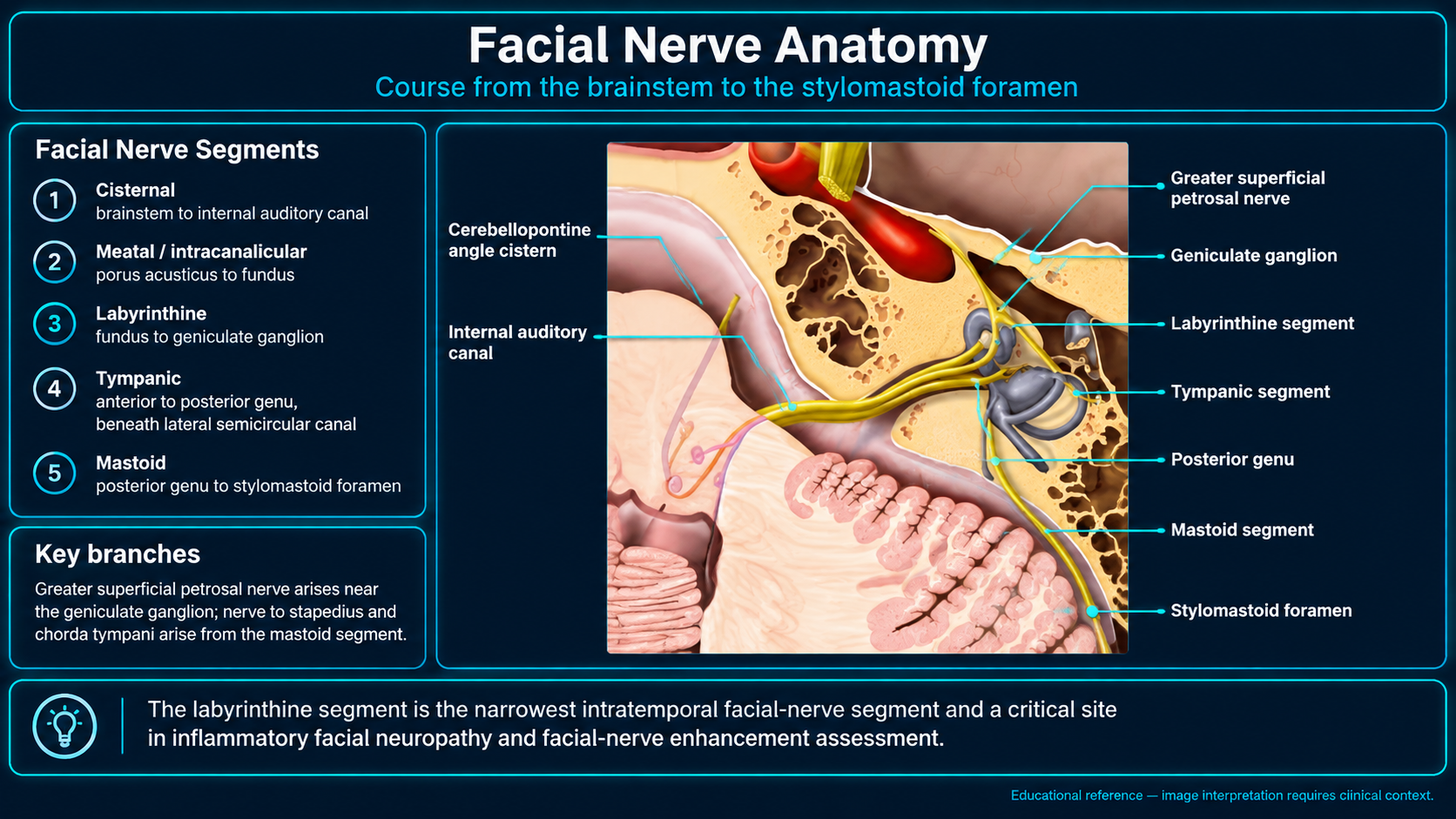Facial nerve course from the brainstem to the stylomastoid foramen