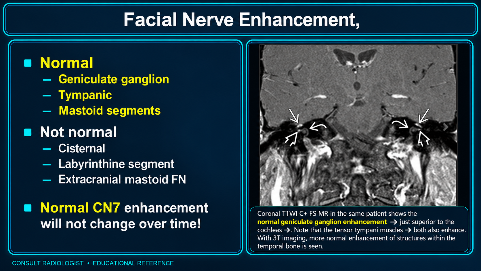 Normal and abnormal facial nerve enhancement patterns