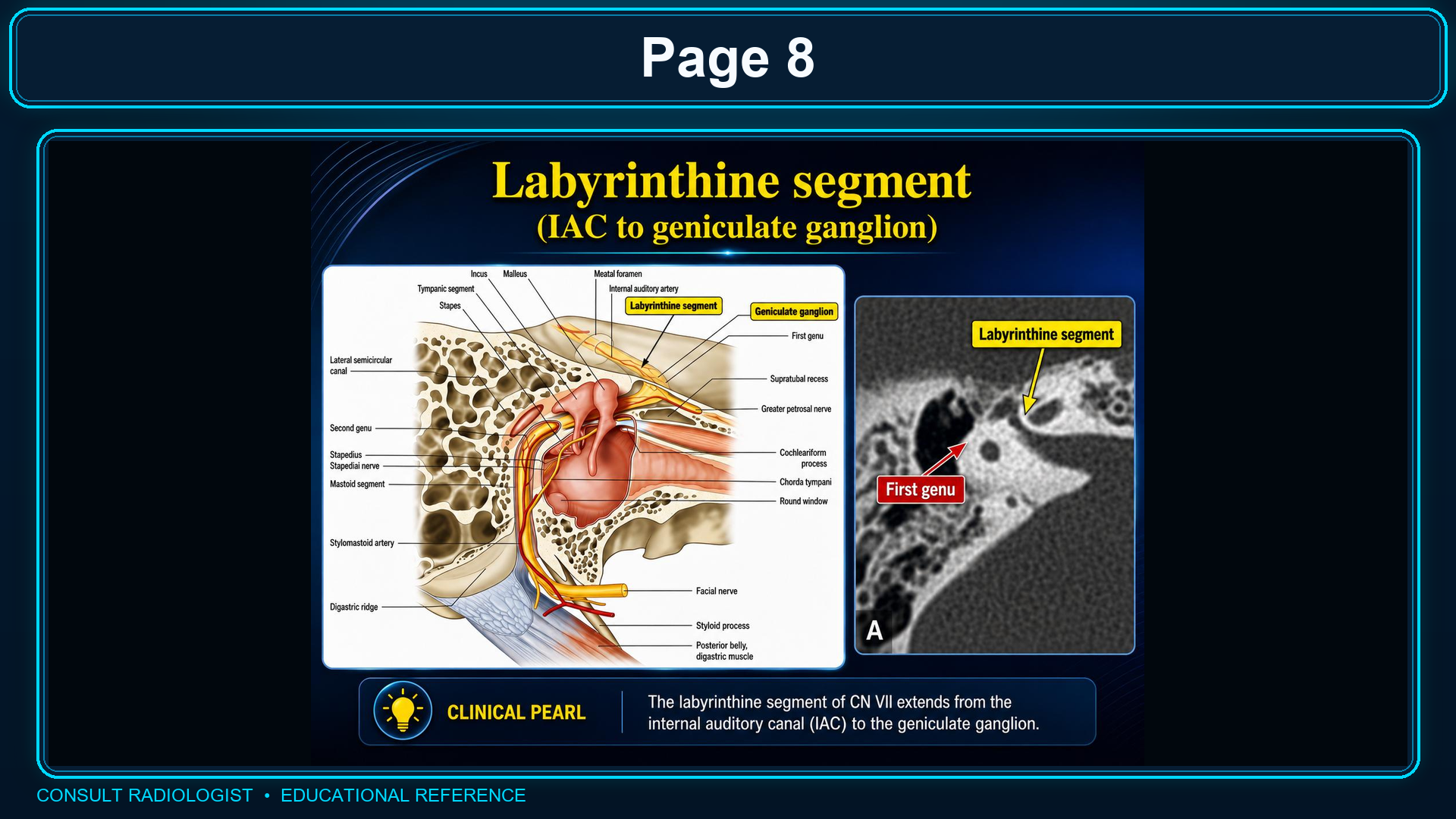 Labyrinthine facial nerve segment from the IAC to the geniculate ganglion