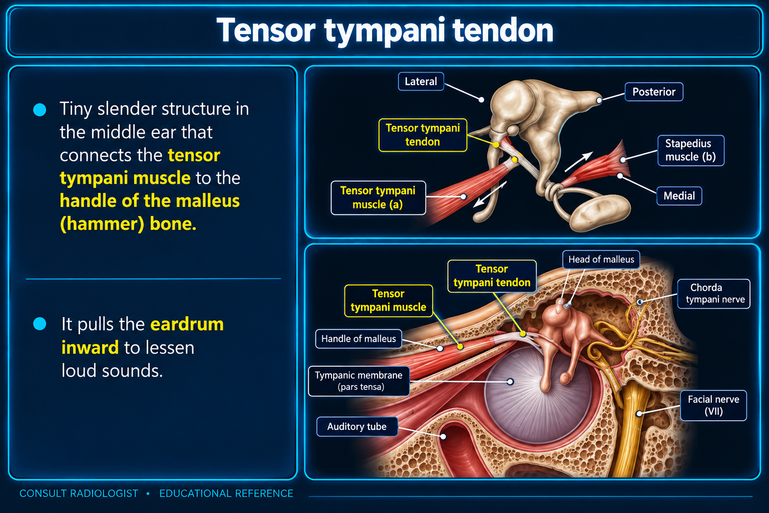 Tensor tympani tendon and adjacent facial nerve anatomy